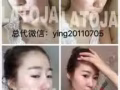 改善痘痘肌，敏感肌，痘印，改善皱纹，美白淡斑！