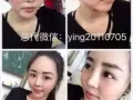 改善痘痘肌，敏感肌，痘印，改善皱纹，美白淡斑！