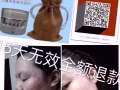 祛痘膏专治痘痘、痘印、美白、控油、承诺15天无效全额退款。
