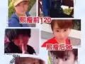 熙瘦减肥塑型！独家代理！！！月瘦8️⃣到3️⃣0️⃣斤，
