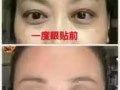 1度眼貼（ 呵護眼睛，1度眼貼，緩解眼疲勞乾澀痛，黑眼圈，眼袋，降低近視，結膜炎