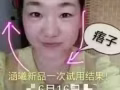 涵曦排毒针外用涂抹，不打针，不开刀，轻松搞定小V脸！