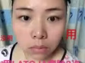 涵曦排毒針外用塗抹，不打針，不開刀，輕鬆搞定小V臉！