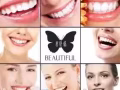 碧緹福美牙儀－－最便攜且安全有效的美白牙齒儀器