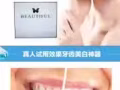 碧缇福美牙仪－－最便携且安全有效的美白牙齿仪器
