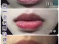 修復受損唇部乾燥脫皮