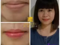 修復受損唇部乾燥脫皮,唇白，唇烏