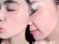 MissZhang张馨予自创品牌护肤品涂抹式水光针