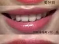 最簡單方便，安全有效的碧緹福美牙儀