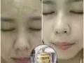 一款可以治疗各种皮肤的产品，深海珍珠膏！回头率百分百