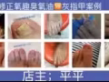 灰指甲，腳氣，痔瘡，痘痘，純天然治療