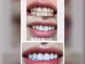 你需要的美牙仪