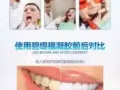 牙齿美白仪