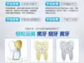 牙齿美白仪