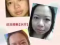 水疗，排毒，脸部拨筋，美白祛斑