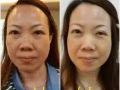 水疗，排毒，脸部拨筋，美白祛斑