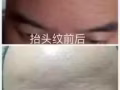 给我一分钟，保证让您年轻
