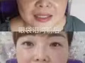 给我一分钟，保证让您年轻