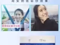 香港利特生物科技【炫妃美牙仪】