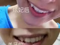 香港利特生物科技【炫妃美牙仪】