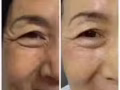 活肤肌底液和玻尿酸维他命c精华！精华！