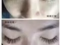 中医理疗，美容纹绣，睫毛嫁接
