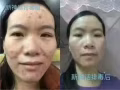 新神話臉部排毒抗衰液