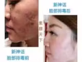 新神話臉部排毒抗衰液