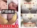 貼針灸豐胸，我手上有有9盒全部只要$200