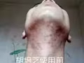 七天祛痘十天无印还你一个健康美丽的脸