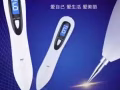 智能激光点痣