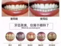 碧缇福美牙仪