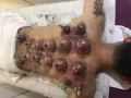 中医推拿！