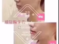 韩式微整（韩国医院文凭）