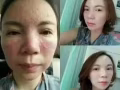 純中草藥藥療，首次體驗38