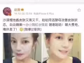 活酵母