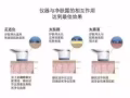 超好用的洗脸机