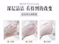 祛痘痘滋活排毒