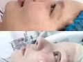 韩式微整大优惠哦