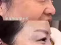 韩式微整大优惠哦