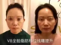 韓式微整大優惠哦
