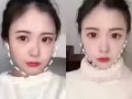 韓式微整大優惠哦