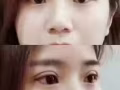 韓式微整大優惠哦
