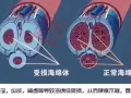 契默契蟻王