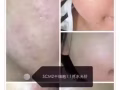 微整容
