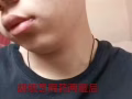 祛痘排毒
