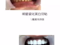 美容美牙
