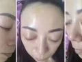 韓國水光針，保證一次見效