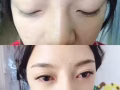 睫毛嫁接