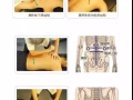 原始点推拿 养生兼治病，对头痛 颈椎病 胃病 腰疼 腰间盘突出 妇科病等有明显效